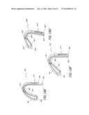 SPINAL IMPLANT diagram and image