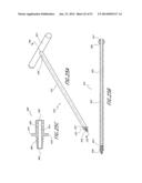 SPINAL IMPLANT diagram and image