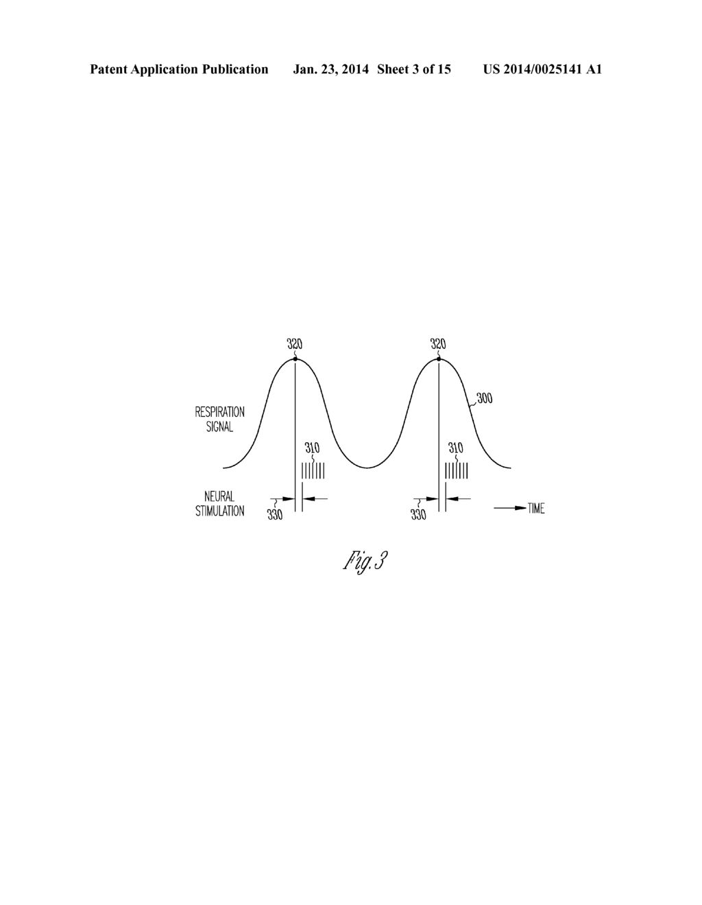 METHOD AND APPARATUS FOR NEURAL STIMULATION WITH RESPIRATORY FEEDBACK - diagram, schematic, and image 04