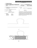 Retrievable stent for intracranial aneurysms diagram and image