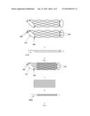 Retrievable stent for intracranial aneurysms diagram and image