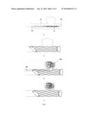 Retrievable stent for intracranial aneurysms diagram and image