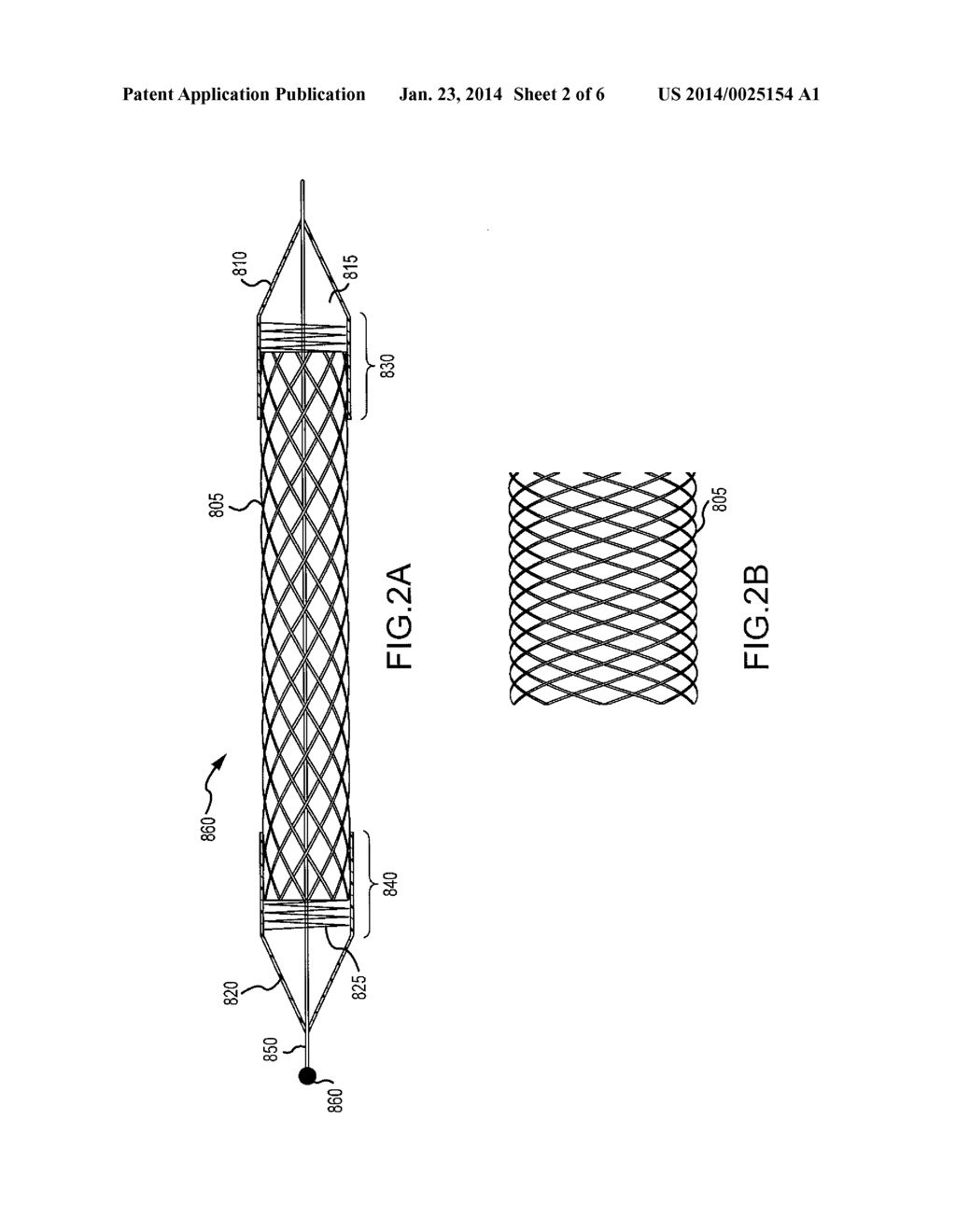 METHODS AND APPARATUS FOR LUMINAL STENTING - diagram, schematic, and image 03