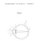 INTRAOCULAR LENS DESIGN METHOD AND INTRAOCULAR LENS diagram and image