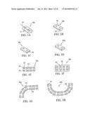 DEVICES AND METHODS FOR STABILIZING TISSUE AND IMPLANTS diagram and image