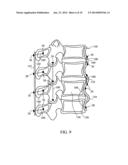 DEVICES AND METHODS FOR STABILIZING TISSUE AND IMPLANTS diagram and image