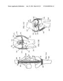 DEVICES AND METHODS FOR STABILIZING TISSUE AND IMPLANTS diagram and image