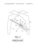 Locking pliers with torque display arrangement diagram and image