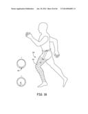 Suspension and Body Attachment System and Differential Pressure Suit for     Body Weight Support Devices diagram and image