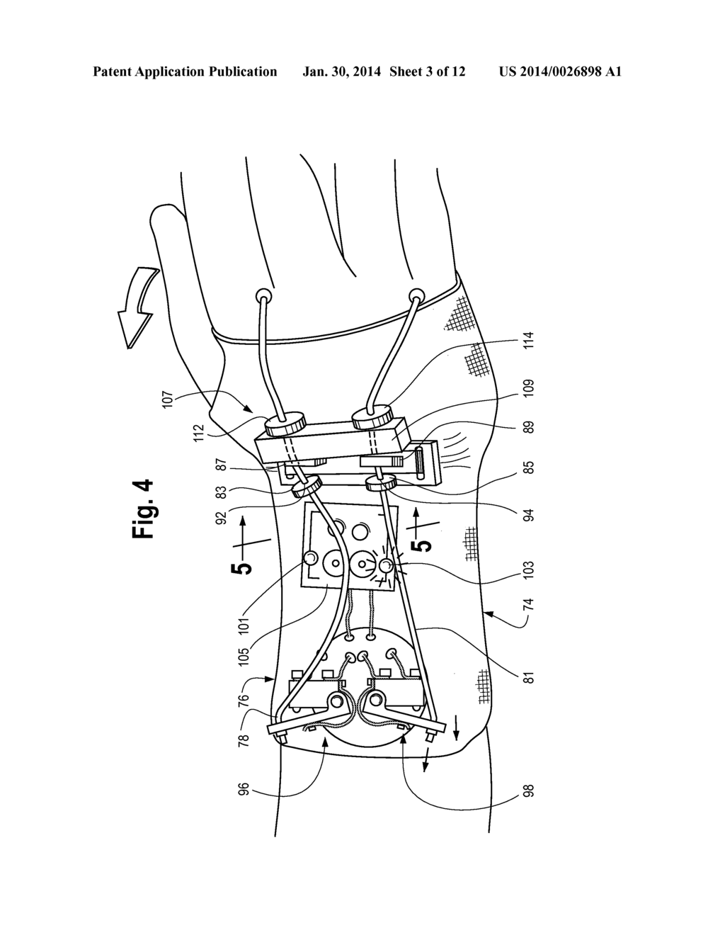 METHOD AND APPARATUS FOR LIMITING RANGE OF MOTION OF THE BODY OF THE USER - diagram, schematic, and image 04