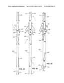 TREE CLIMBING SUPPORT diagram and image