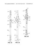 TREE CLIMBING SUPPORT diagram and image