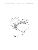 DETACHABLE BUTTRESS MATERIAL RETENTION SYSTEMS FOR USE WITH A SURGICAL     STAPLING DEVICE diagram and image