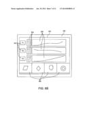 DEPLOYABLE DEVICES AND METHODS OF DEPLOYING DEVICES diagram and image