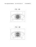 OPHTHALMOLOGIC APPARATUS AND OPHTHALMOLOGIC METHOD diagram and image