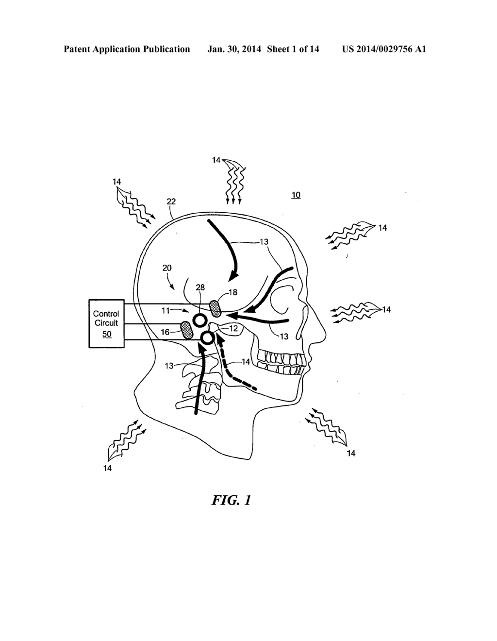 HEARING PROTECTION SYSTEM - diagram, schematic, and image 02