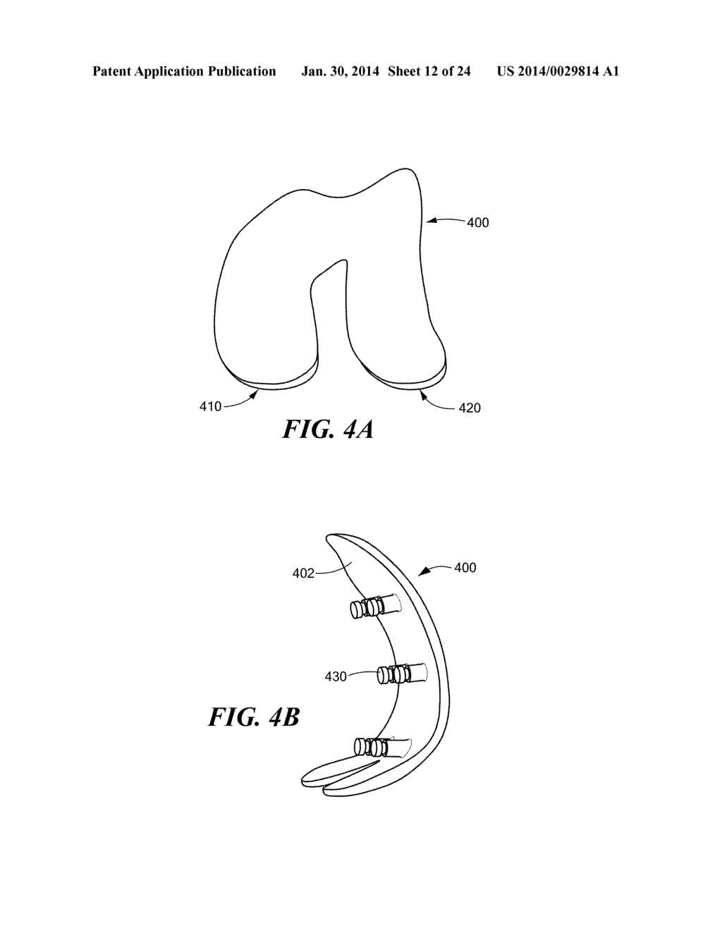 Patient Selectable Knee Arthroplasty Devices - diagram, schematic, and image 13