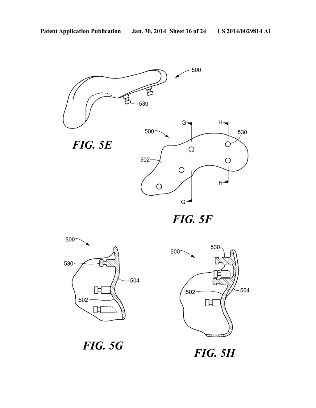 Patient Selectable Knee Arthroplasty Devices - diagram, schematic, and image 17