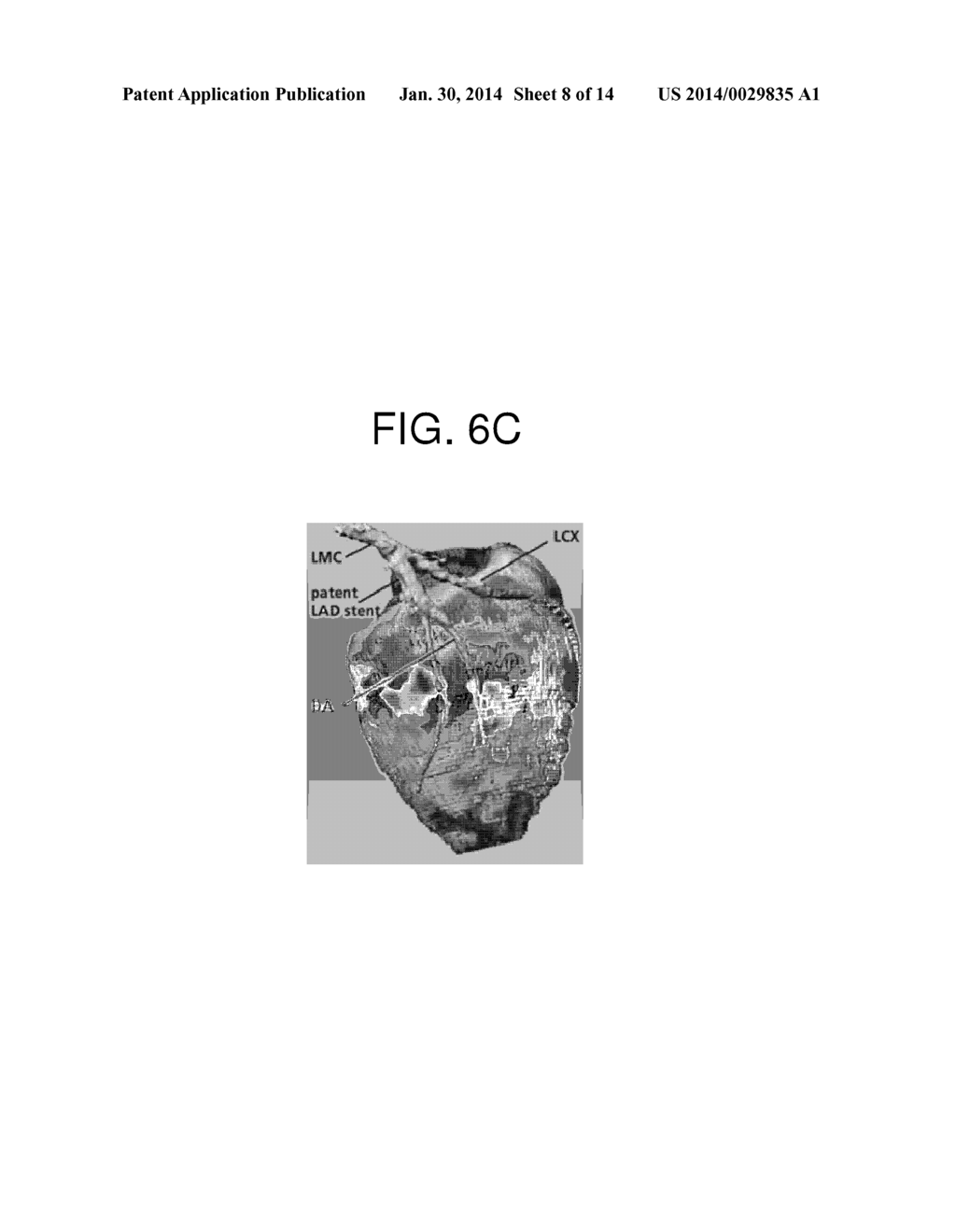 METHOD AND APPARATUS FOR DETERMINING BLOOD FLOW REQUIRED, METHOD AND     APPARATUS FOR PRODUCING BLOOD FLOW IMAGE, AND METHOD AND APPARATUS FOR     PROCESSING MYOCARDIAL PERFUSION IMAGE - diagram, schematic, and image 09