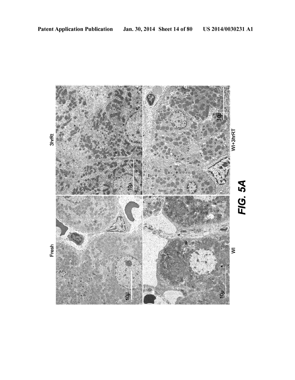 METHODS AND COMPOSITIONS FOR PRESERVING TISSUES AND ORGANS - diagram, schematic, and image 15