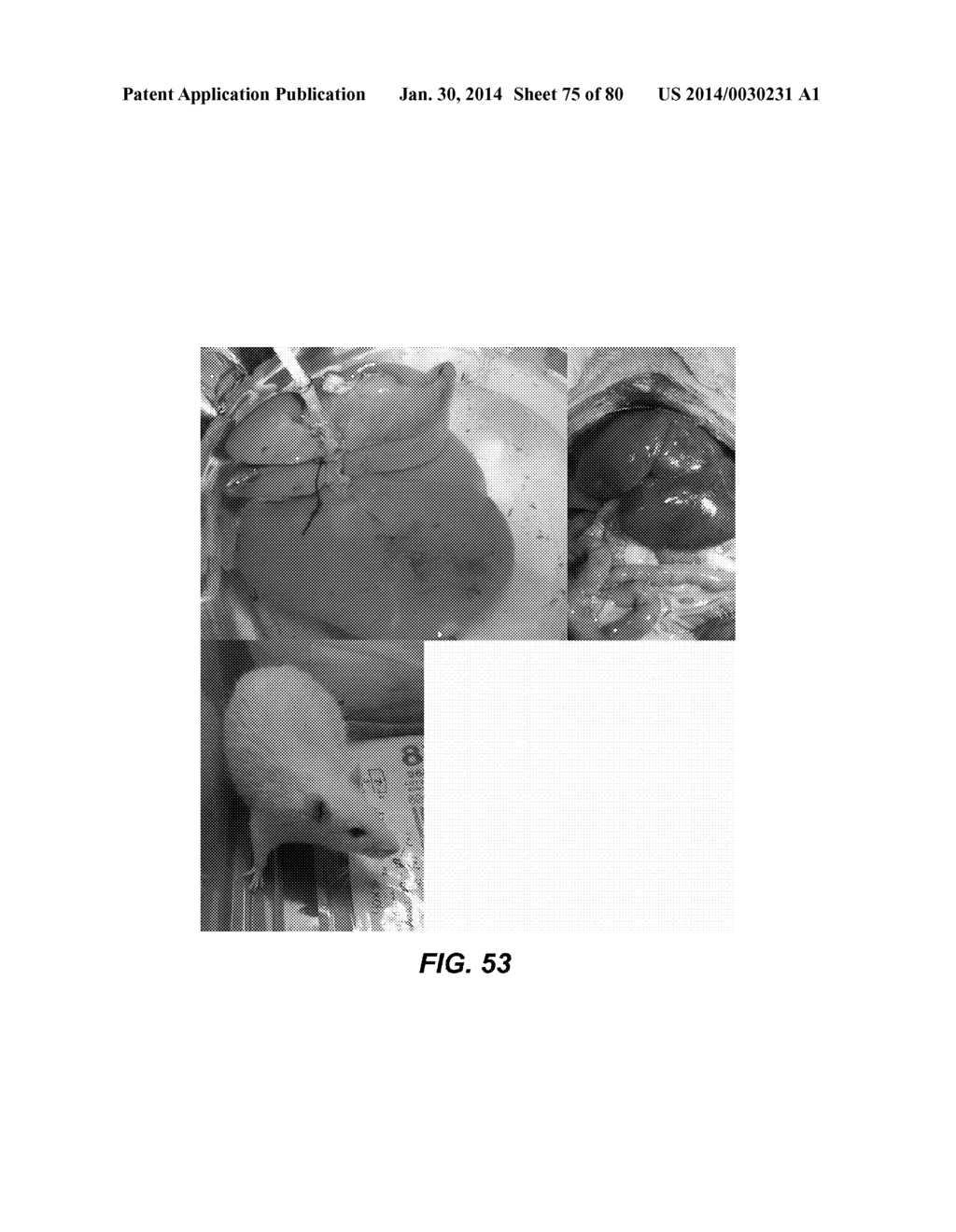 METHODS AND COMPOSITIONS FOR PRESERVING TISSUES AND ORGANS - diagram, schematic, and image 76