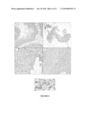 METHODS OF TREATING FGFR3 RELATED CONDITIONS diagram and image