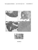 METHODS OF TREATING FGFR3 RELATED CONDITIONS diagram and image