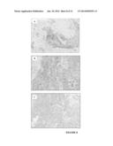 METHODS OF TREATING FGFR3 RELATED CONDITIONS diagram and image