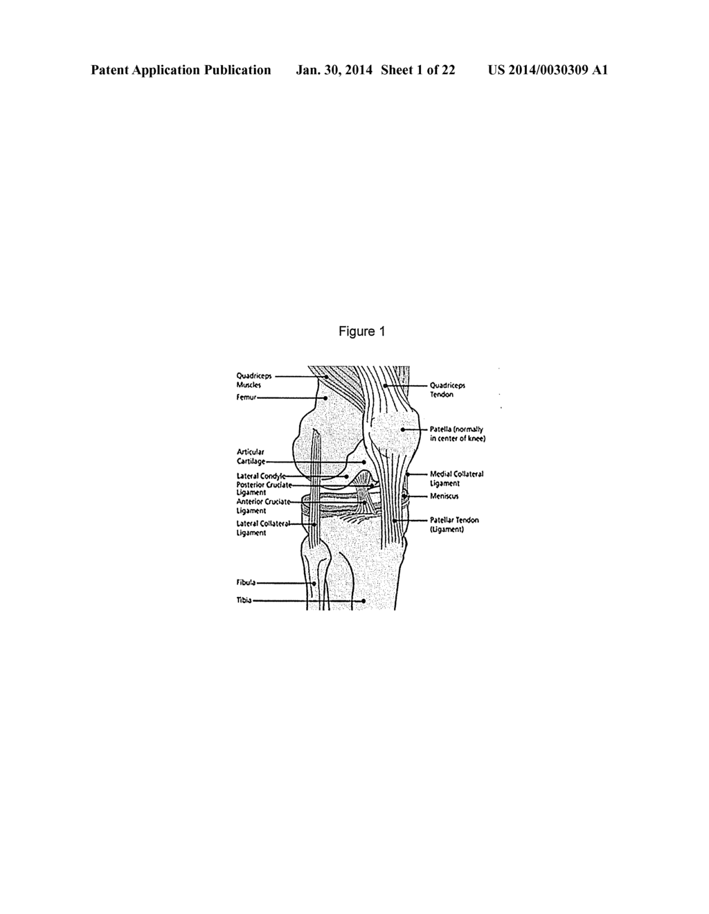 DISRUPTED CARTILAGE PRODUCTS - diagram, schematic, and image 02