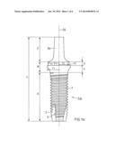 CERAMIC IMPLANT diagram and image