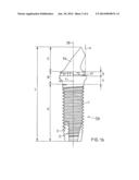 CERAMIC IMPLANT diagram and image