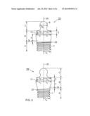 CERAMIC IMPLANT diagram and image