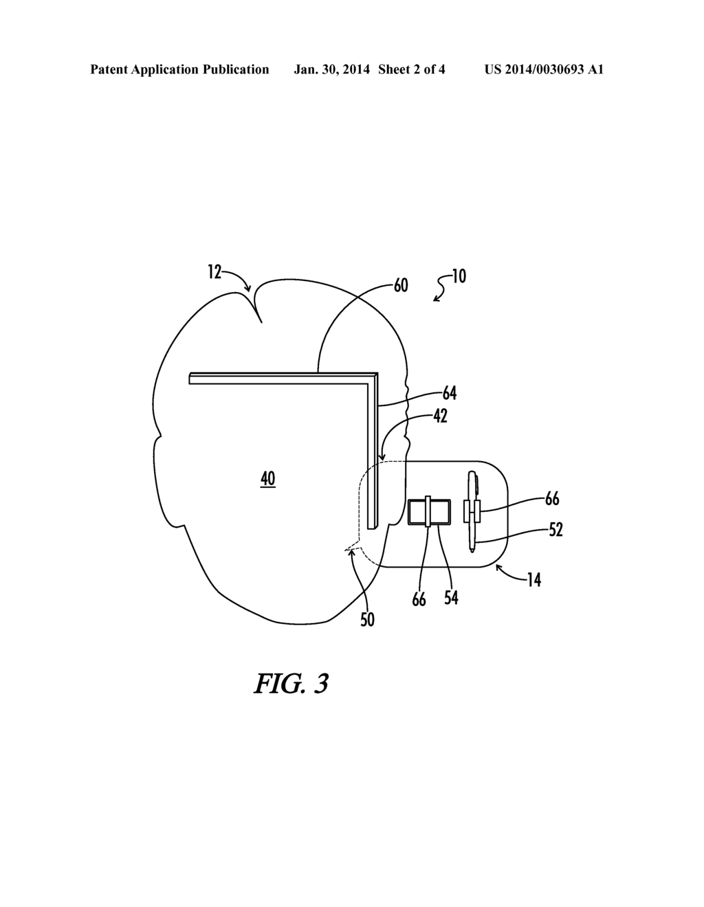 METHOD AND DEVICE FOR REAL TIME EXPRESSION - diagram, schematic, and image 03