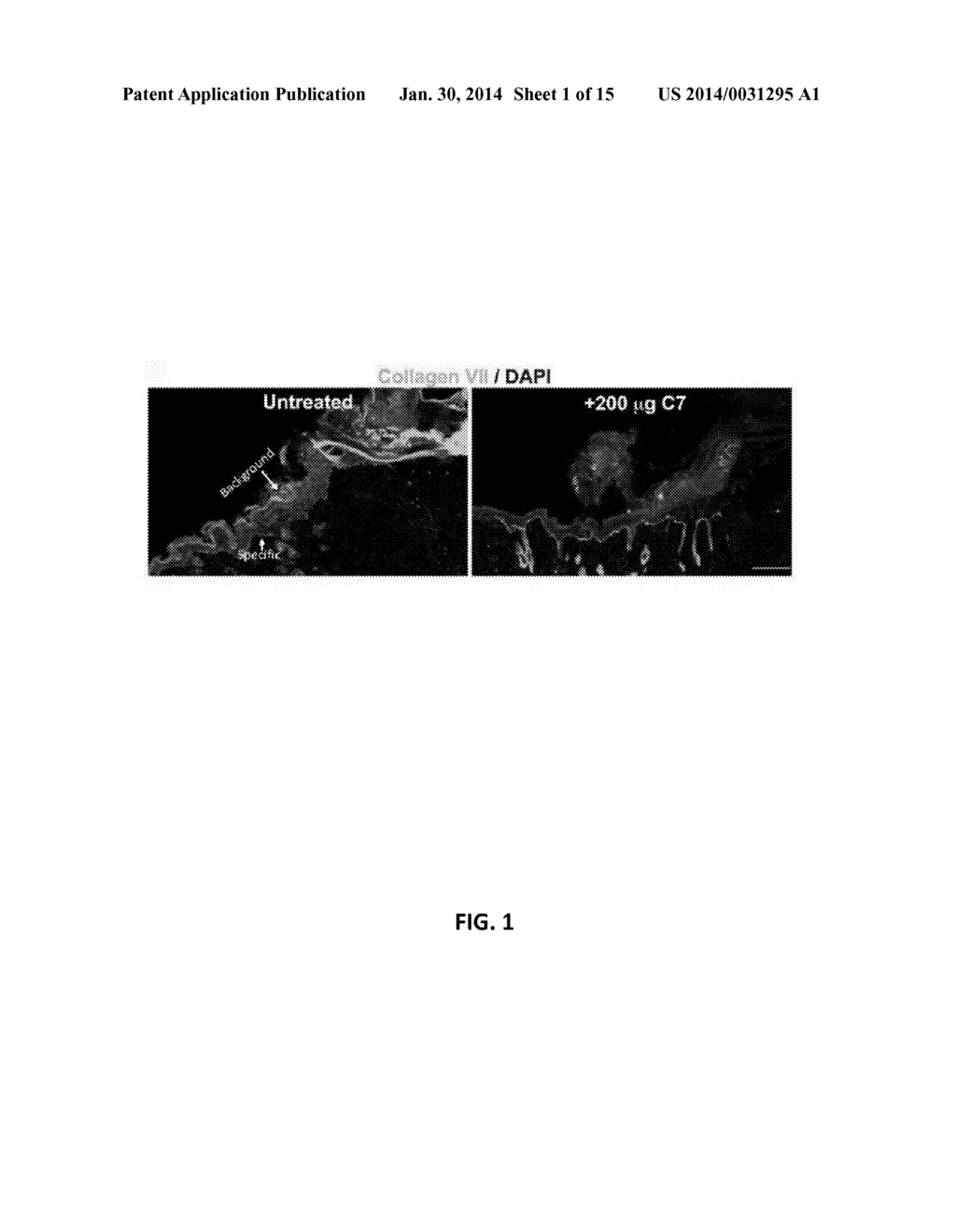 Recombinant C7 and Methods of Use - diagram, schematic, and image 02