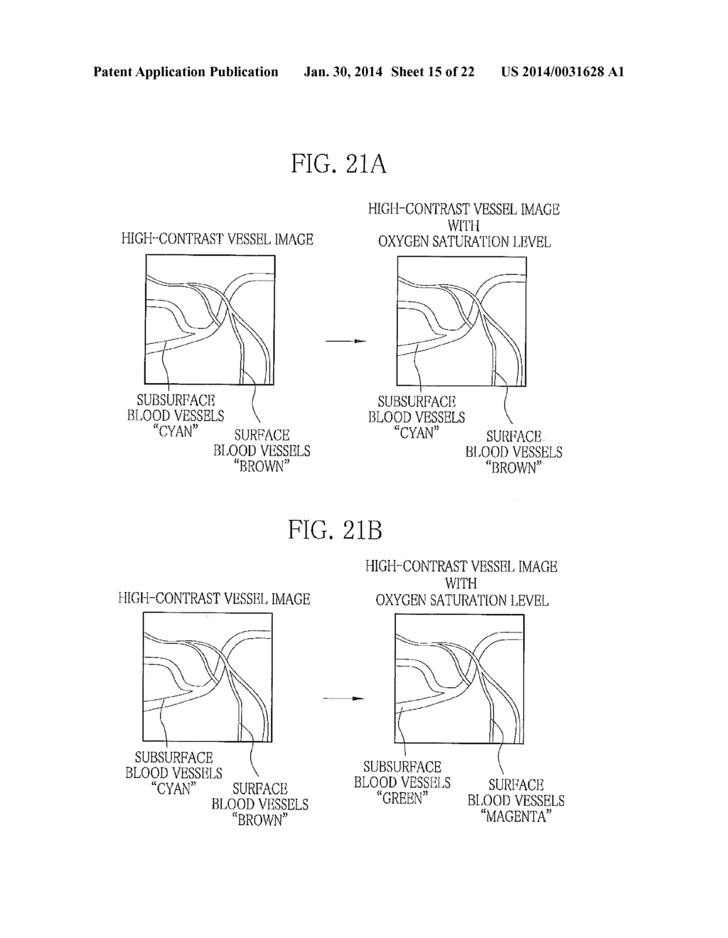 ENDOSCOPE SYSTEM, PROCESSOR DEVICE OF ENDOSCOPE SYSTEM, AND METHOD FOR     CONTROLLING DISPLAY OF ENDOSCOPE IMAGE - diagram, schematic, and image 16