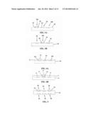 Medical Device Insertion diagram and image