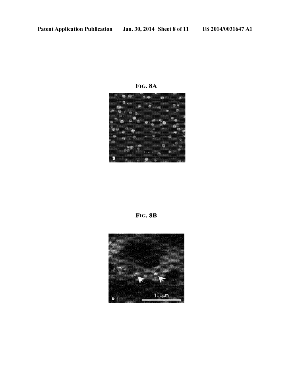 IN VIVO FLOW CYTOMETRY BASED ON CELLULAR AUTOFLUORESCENCE - diagram, schematic, and image 09