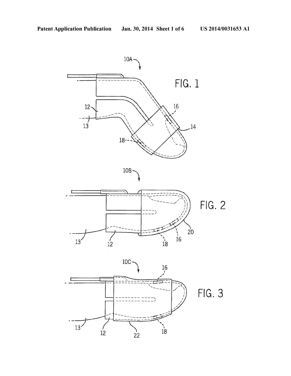 MEDICAL SENSOR FOR REDUCING ARTIFACTS AND TECHNIQUE FOR USING THE SAME - diagram, schematic, and image 02