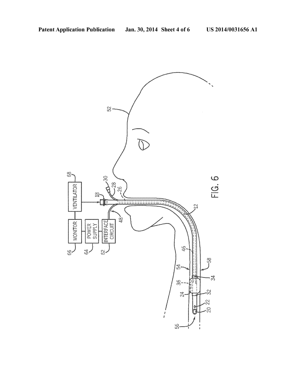 TRACHEAL TUBE SENSOR DISPOSED ON PERMEABLE MEMBRANE - diagram, schematic, and image 05