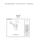 RADIOGRAPHIC IMAGING DEVICE diagram and image