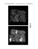 SYSTEMS FOR FUSION OF FLUORESCENCE MOLECULAR TOMOGRAPHY AND MAGNETIC     RESONANCE IMAGES diagram and image