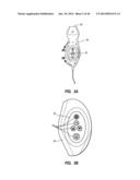 Needle Assembly Including an Aligned Magnetic Element diagram and image