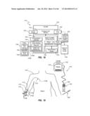 Needle Assembly Including an Aligned Magnetic Element diagram and image