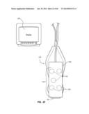 Needle Assembly Including an Aligned Magnetic Element diagram and image