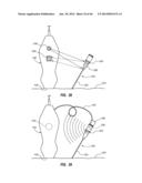 Needle Assembly Including an Aligned Magnetic Element diagram and image