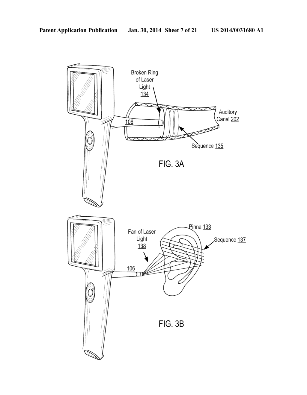 Otoscanner With 3D Imaging And Onboard Tracking - diagram, schematic, and image 08