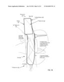 Otoscanner With 3D Imaging And Structure-From-Motion diagram and image