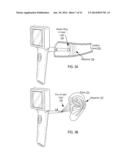 Otoscanner With 3D Imaging And Structure-From-Motion diagram and image