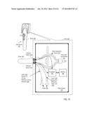 Otoscanner With 3D Imaging And Structure-From-Motion diagram and image