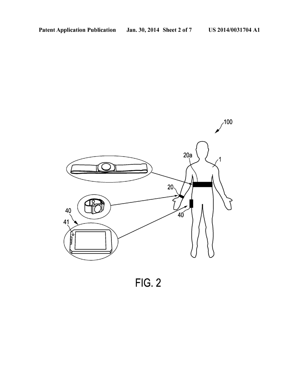 STRESS-MEASURING DEVICE AND METHOD - diagram, schematic, and image 03